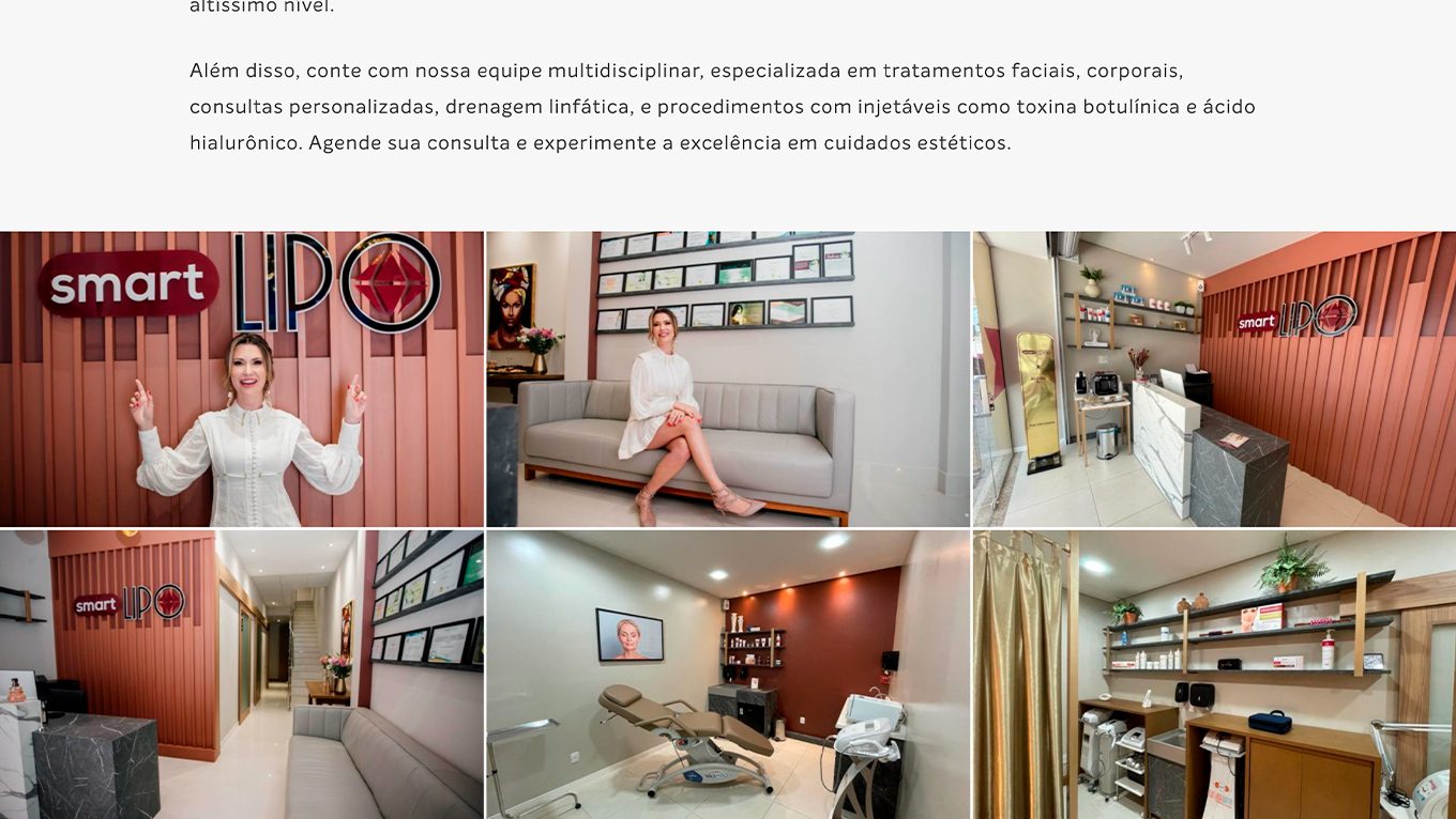 Galeria - SmartLipo